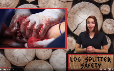 LOG SPLITTER SAFETY