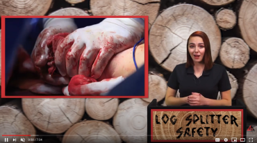 LOG SPLITTER SAFETY video