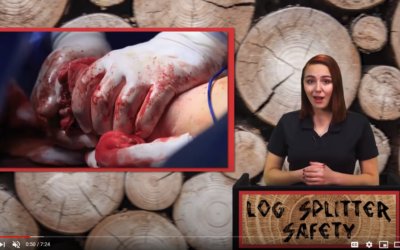 LOG SPLITTER SAFETY